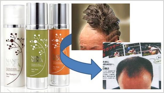 Nanemoga Shampoo (Prevention Hair-loss) 15... Made in Korea
